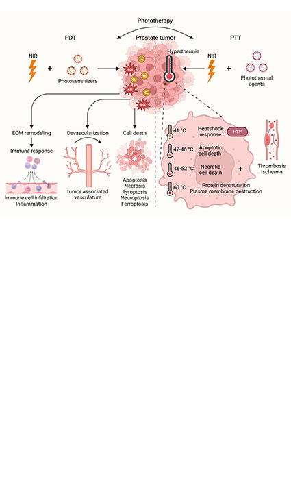 Advances in Illuminating Prostate Cancer with Emerging Phototherapies