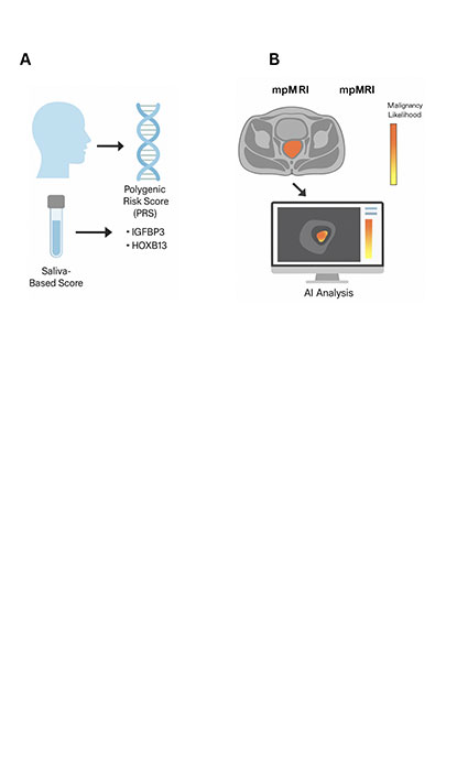 Saliva-Based Polygenic Risk Scores and AI-Enhanced Imaging for Prostate Cancer Screening Beyond PSA