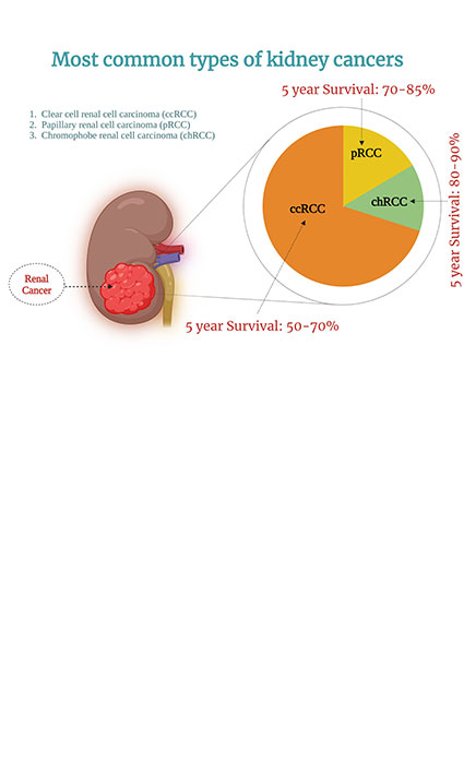 Using Artificial Intelligence to Advance Renal Cancer Diagnosis, Treatment, and Precision Medicine