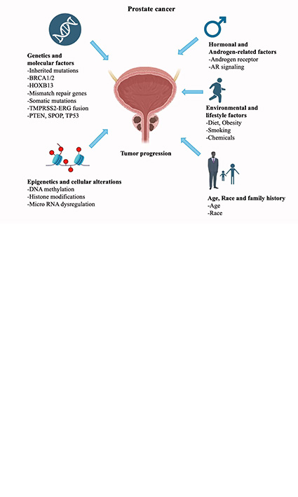 Precision Medicine in Prostate Cancer: The Role of Molecular Diagnostics and Targeted Therapies