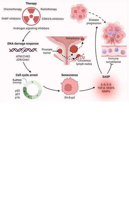 Targeting Cellular Senescence in Prostate Cancer: Molecular Landscape and Therapeutic Avenues